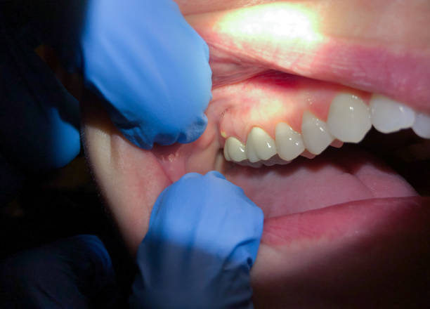 Best Pediatric Emergency Dentist in Pittsboro, NC